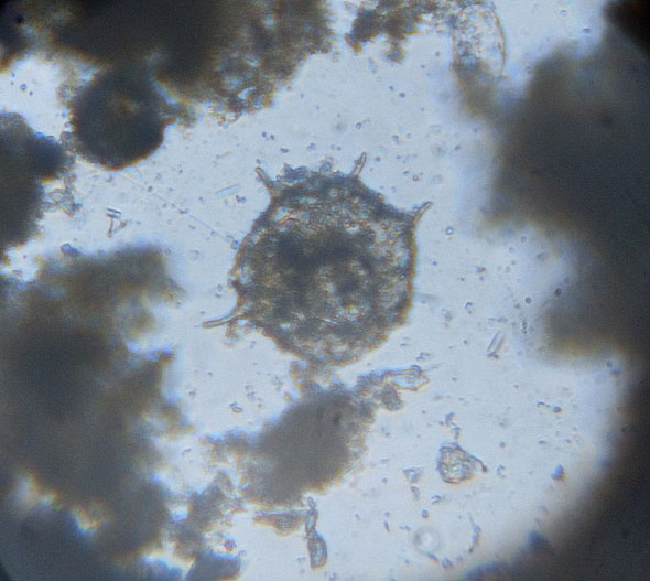 Tecamoeba